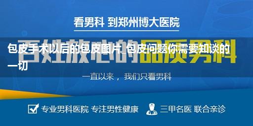 包皮手术以后的包皮图片_包皮问题你需要知谈的一切